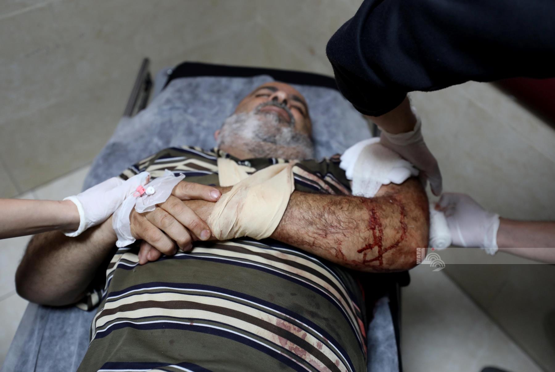 مواطنون يتلقون العلاج بعد اصابتهم بهجوم المستعمرين على قرية دوما جنوب نابلس (تصوير: أيمن النوباني/وفا)